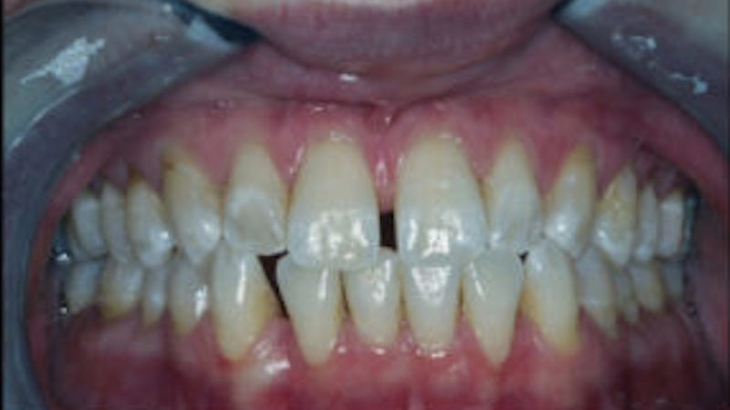 before dental treatment