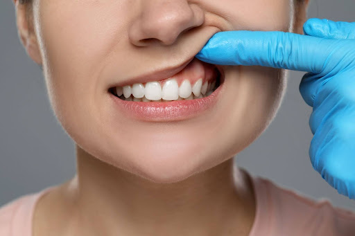 dentist examines patient’s gum health