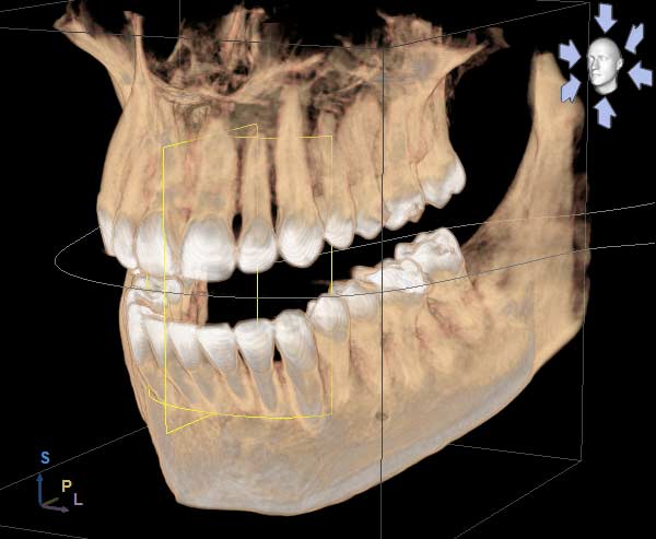 3D imaging at Madison Dental Care