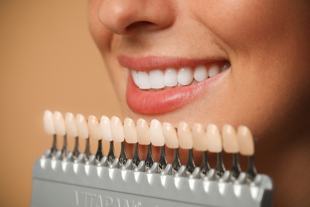cosmetic dentistry treatment tooth color comparison